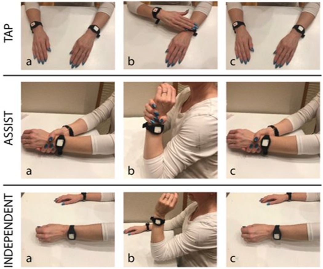 The Feasibility and User Experience of a Program of Progressive Cued Activity to Promote Functional Upper Limb Activity in the Inpatient Rehabilitation Setting with Follow-Up at Home.