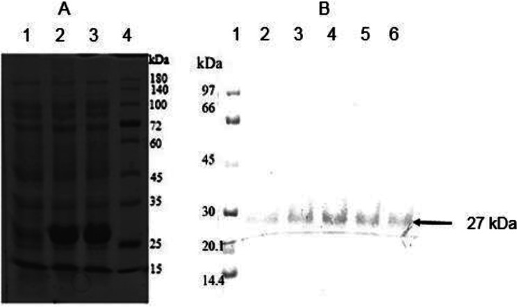 Pattern of sensitization to yellow jacket venom and expression of recombinant antigen 5 (Ves v 5) from yellow jacket venom.
