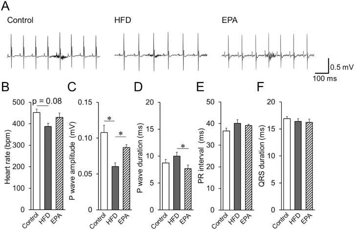 Eicosapentaenoic acid prevents atrial electrocardiographic impairments and atrial fibrillation in high fat diet mice.