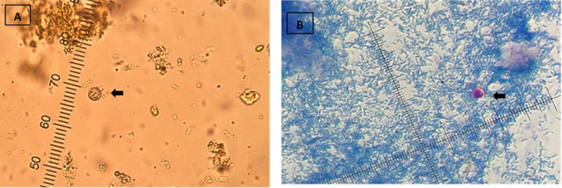 Molecular confirmation of Cryptosporidium and Cyclospora species in children with acute diarrhoea in Quindio region, Colombia.