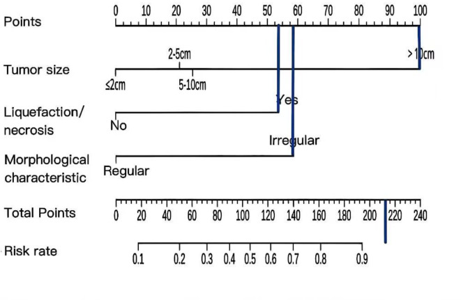 Study on the predictive value of preoperative CT features for the mitotic index of GIST based on the nomogram.