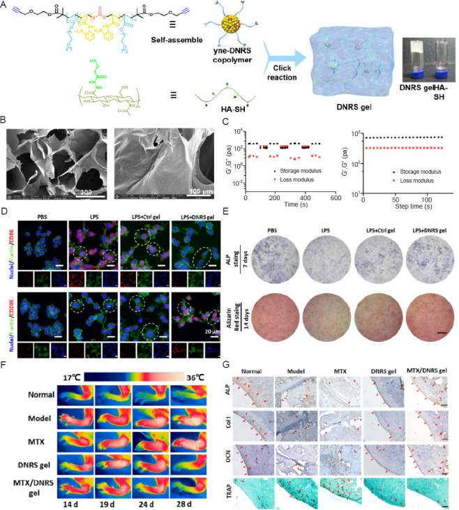 Advances in injectable drug delivery systems for the treatment of rheumatoid arthritis.