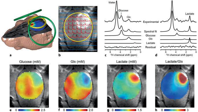 [Multiparametric magnetic resonance imaging of the breast : What can we expect from the future?]