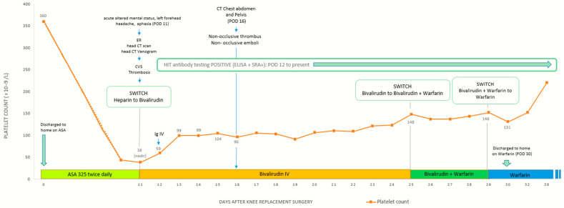 Acute Intracerebral Hemorrhage Associated with Extensive Venous Thrombosis Due to Spontaneous Heparin-Induced Thrombocytopenia After Total Knee Replacement: A Case Report.