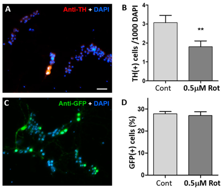 Neuroprotective Role of Cyclic AMP Signaling in Dopaminergic Degeneration Induced by a Parkinson's Disease Toxin, Rotenone.