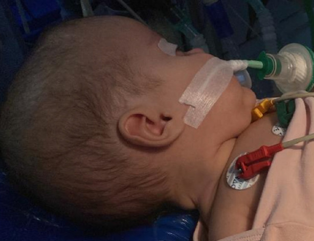 Anaesthesia Considerations on Paediatric Neurosurgery.