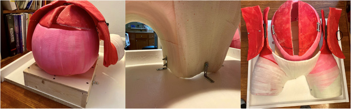 Development of a cost-effective, reusable, resuscitative hysterotomy task trainer for emergency medicine trainees.