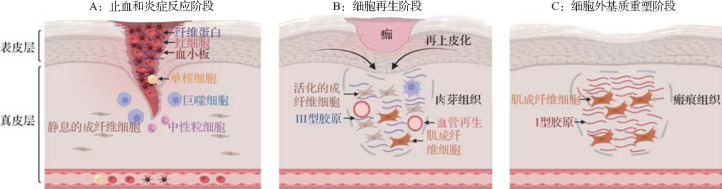 [Research progress on collagen secretion mechanisms in scarring].