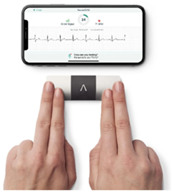 How Can Podiatrists and Other Health Care Professionals Support the Detection of Atrial Fibrillation?
