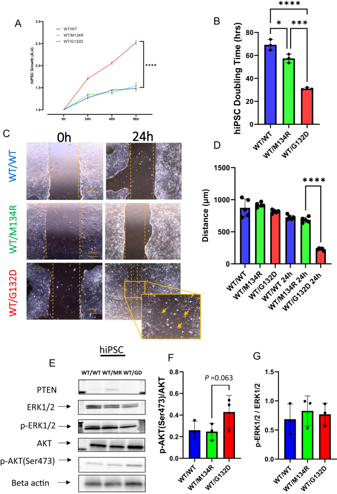 Divergent PTEN-p53 interaction upon DNA damage in a human thyroid organoid model with germline PTEN mutations.
