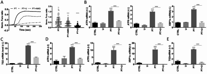 The CXCR3/PLC/IP3-IP3R axis is responsible for the ignition of UPR in intestinal epithelial cells exposed to gliadin peptide, during the onset of celiac disease.