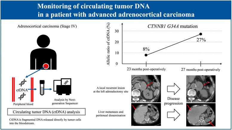 Adrenocortical carcinoma with circulating tumor DNA analysis at post-operative recurrence: a case report with review of literature.