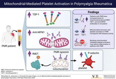 Mitochondrial-Mediated Platelet Activation in Polymyalgia Rheumatica.