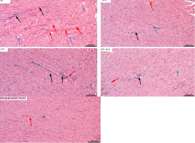 Protective effects of lipid emulsion on vital organs through the LPS/TLR4 pathway in acute organophosphate poisoning.