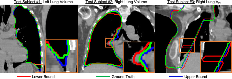 Metric-Guided Conformal Bounds for Probabilistic Image Reconstruction.