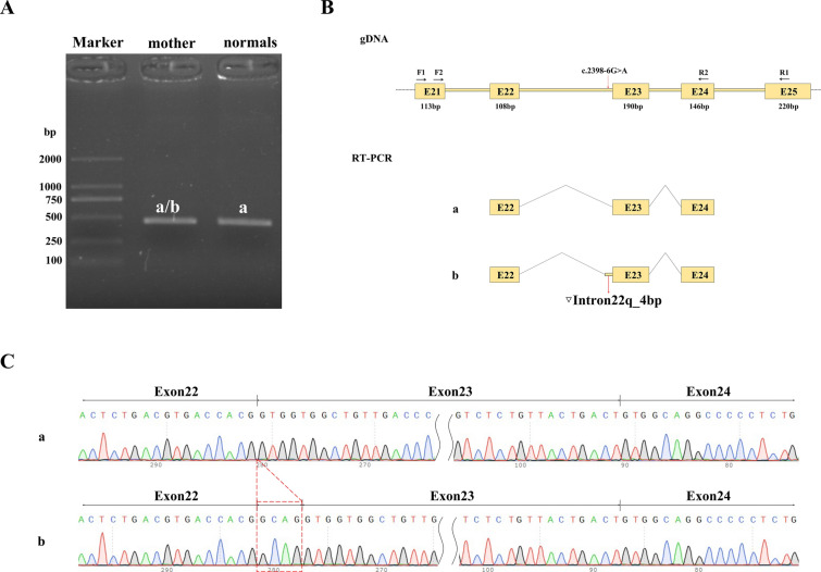 Identification of novel CDH23 heterozygous variants causing autosomal recessive nonsyndromic hearing loss.