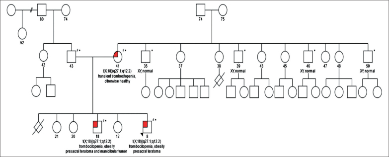 Value of Optical Genome Mapping (OGM) for Diagnostics of Rare Diseases: A Family Case Report.