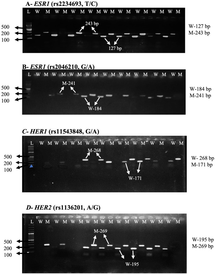 Association of ESR1, HER1, and HER2 Polymorphisms with Breast Cancer Risk in the KP Population, A Case-Control Study.