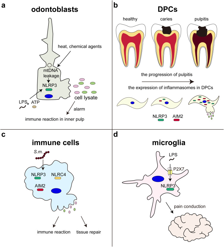 Roles of Pyroptosis in the Progression of Pulpitis and Apical Periodontitis.