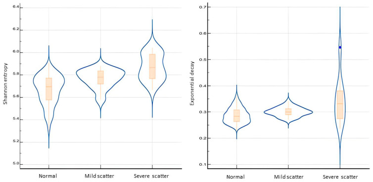 A Novel Trans-Impedance Matrix (TIM) Abnormality Pattern in Cochlear Implants.