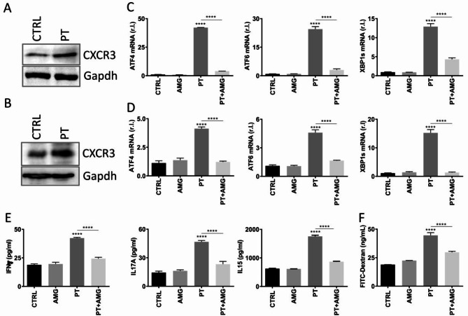 The CXCR3/PLC/IP3-IP3R axis is responsible for the ignition of UPR in intestinal epithelial cells exposed to gliadin peptide, during the onset of celiac disease.