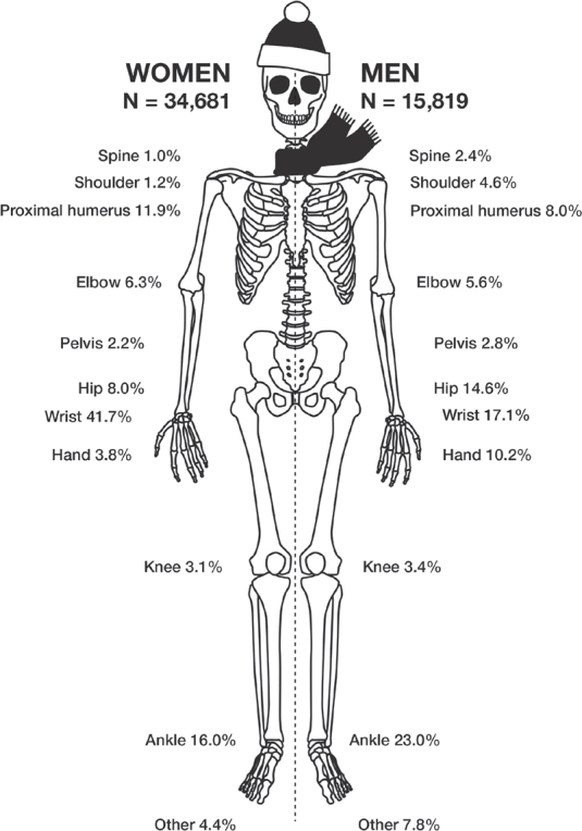 Fractures sustained by slipping on ice or snow: an epidemiological study of 50,500 fractures from the Swedish Fracture Register.