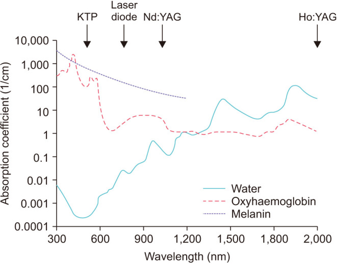 Comparative efficacy and safety of energy coagulation in radiation-induced hemorrhagic cystitis: A narrative review.
