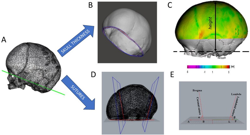 Towards a radiation free numerical modelling framework to predict spring assisted correction of scaphocephaly.