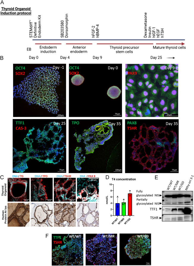 Divergent PTEN-p53 interaction upon DNA damage in a human thyroid organoid model with germline PTEN mutations.