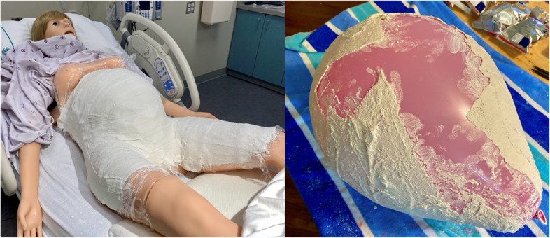 Development of a cost-effective, reusable, resuscitative hysterotomy task trainer for emergency medicine trainees.
