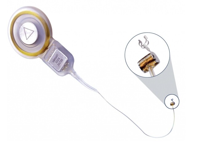 Effect of active middle ear implant on auditory speech perception in individuals with ear malformation.