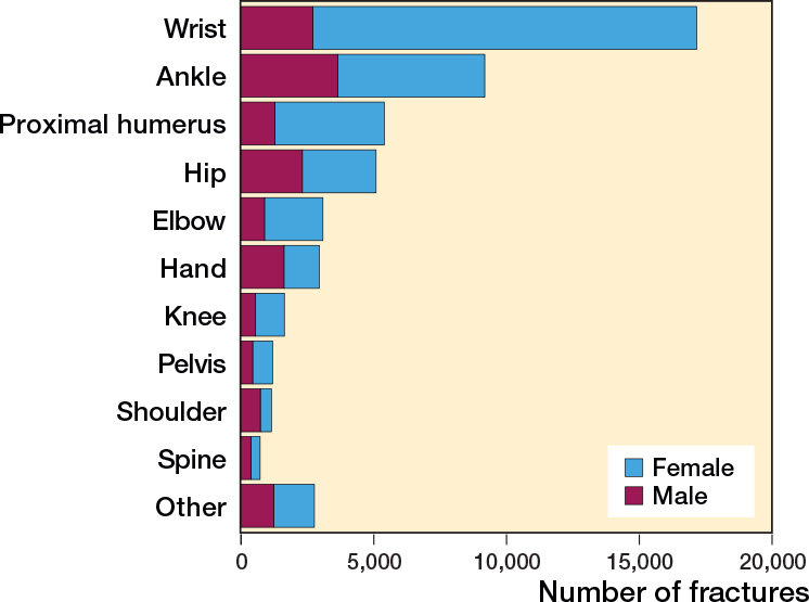 Fractures sustained by slipping on ice or snow: an epidemiological study of 50,500 fractures from the Swedish Fracture Register.