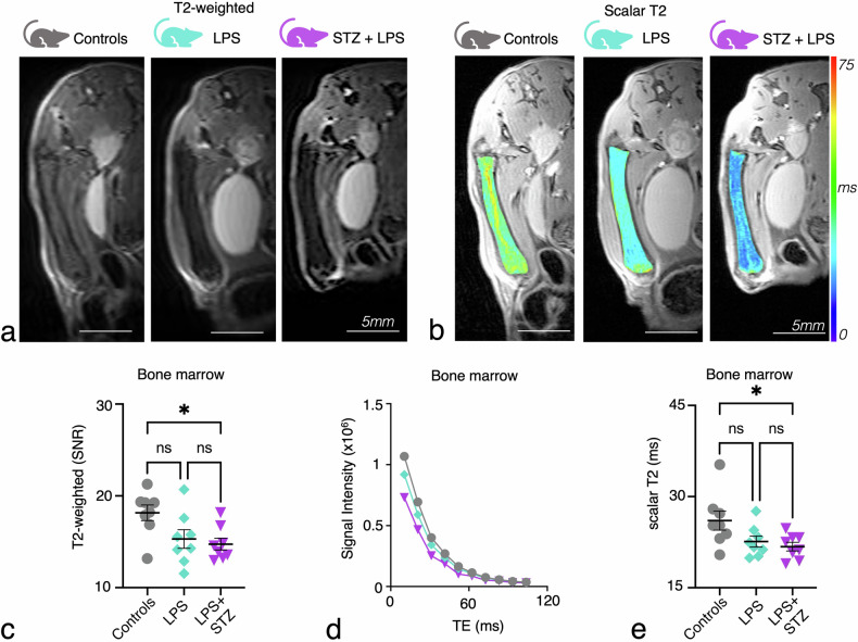 Improved MRI detection of inflammation-induced changes in bone marrow microstructure in mice: a machine learning-enhanced T2 distribution analysis.