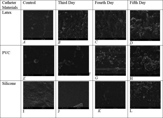 Adhesion Study of <i>Pseudomonas aeruginosa</i> on Different Urinary Catheter Materials.