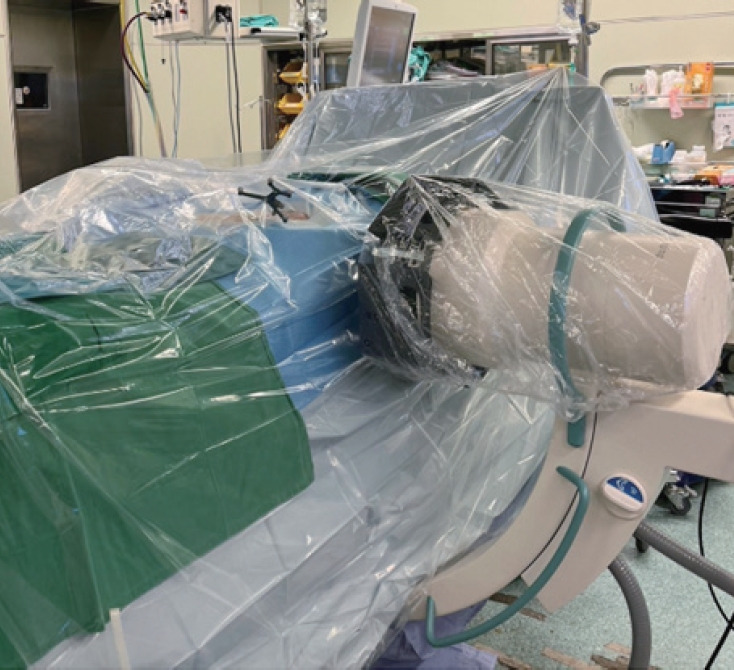 The Utilization of Navigation and Emerging Technologies With Endoscopic Spine Surgery: A Narrative Review.