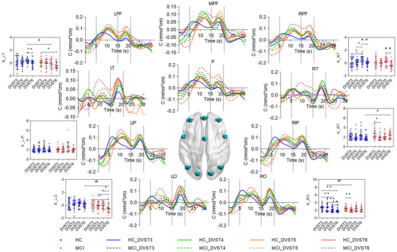 Study on cognitive impairment evaluation based on photoelectric neural information.