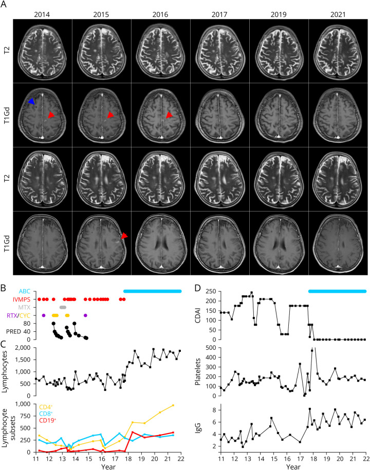 Abatacept Induces Long-Term Reconstitution of the B-Cell Niche in a Patient With CTLA-4 Haploinsufficiency: A Case Report.