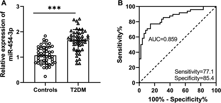 Abnormal expression of miR-454-3p in type 2 diabetes mellitus induces dysfunction of pancreatic β cells by regulating Yy1.
