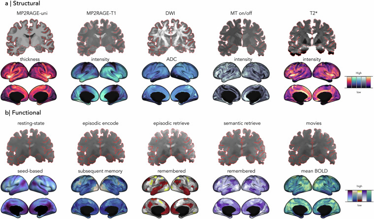 Multimodal precision MRI of the individual human brain at ultra-high fields.