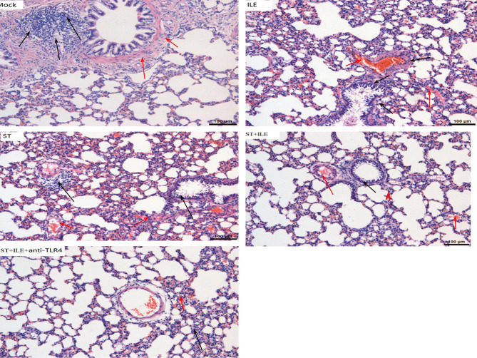 Protective effects of lipid emulsion on vital organs through the LPS/TLR4 pathway in acute organophosphate poisoning.