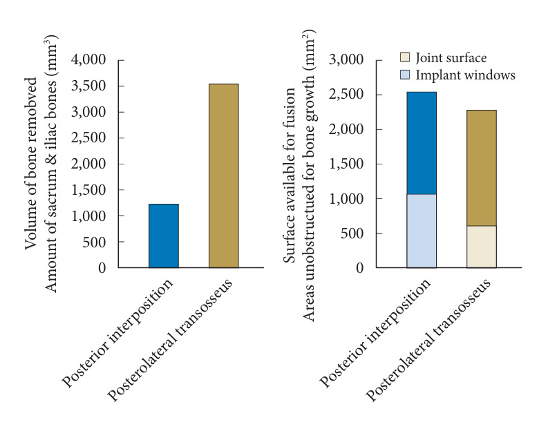 Fixation of the Sacroiliac Joint: A Cadaver-Based Concurrent-Controlled Biomechanical Comparison of Posterior Interposition and Posterolateral Transosseous Techniques.