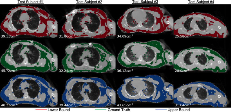 Metric-Guided Conformal Bounds for Probabilistic Image Reconstruction.