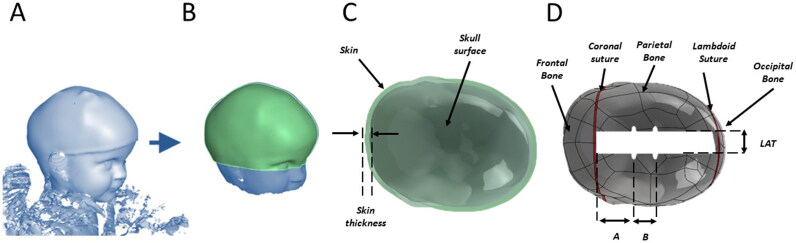 Towards a radiation free numerical modelling framework to predict spring assisted correction of scaphocephaly.