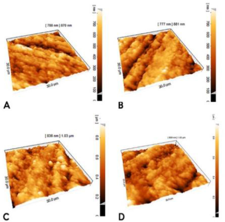 Effect of Er:YAG Laser Irradiation with Various Power Levels on Shear Bond Strength of Repair to Aged Nanofilled Composite Resin.