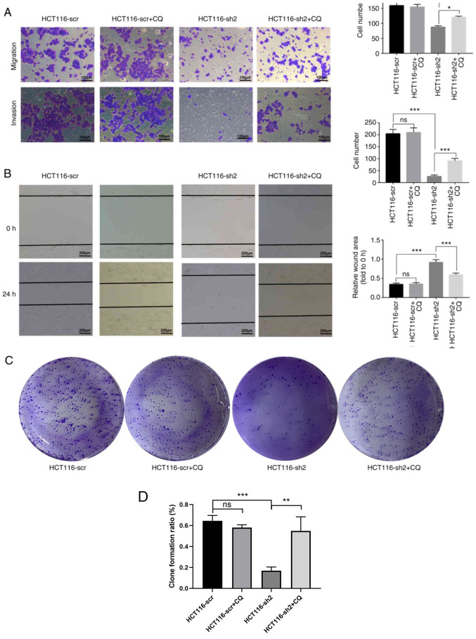 [Corrigendum] Upregulated NTF4 in colorectal cancer promotes tumor development via regulating autophagy.