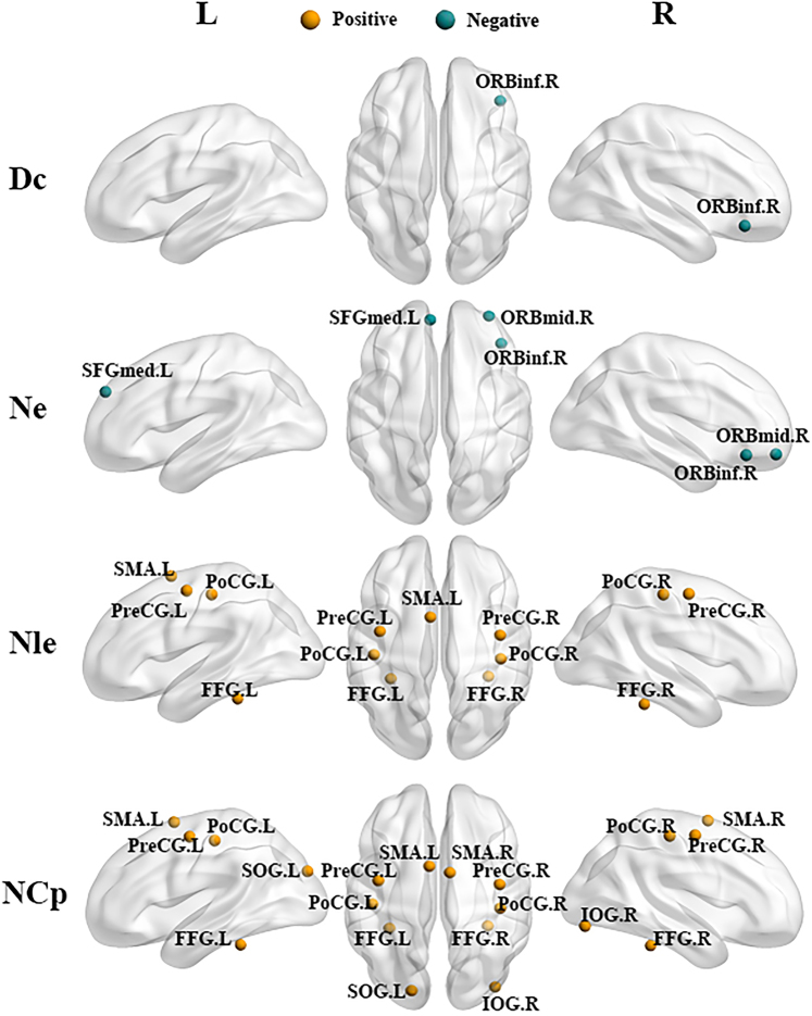 Brain network alterations in mobile phone use problem severity: A multimodal neuroimaging analysis.