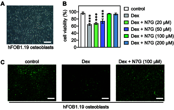 The role of the PKCζ/JNK signaling pathway in regulating the development of femoral head necrosis.