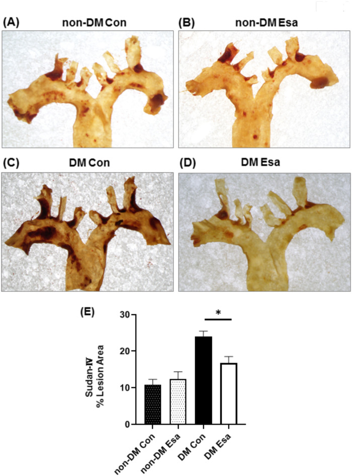 Blocking mineralocorticoid signaling with esaxerenone reduces atherosclerosis in hyperglycemic ApoE KO mice without affecting blood pressure and glycolipid metabolism.
