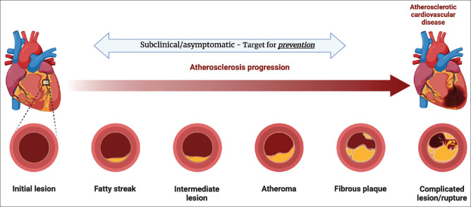 Frontiers in subclinical atherosclerosis and the latest in early life preventive cardiology.