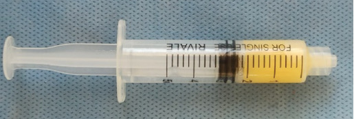 Alveolar Ridge Preservation Using a Mixture of Alb-PRF and Alloplastic Bone Graft: A Case Report.